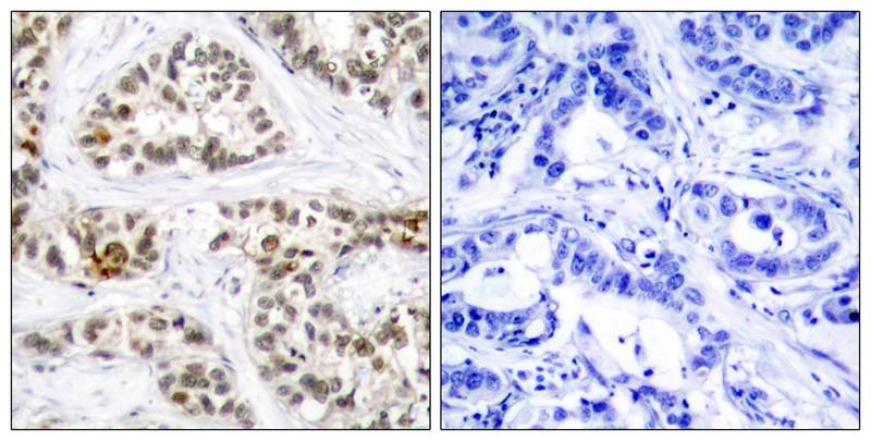 Anti-Phospho-RELB (Ser573) Polyclonal Antibody