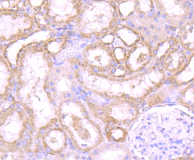 Anti-PSME1 Antibody (8P627)
