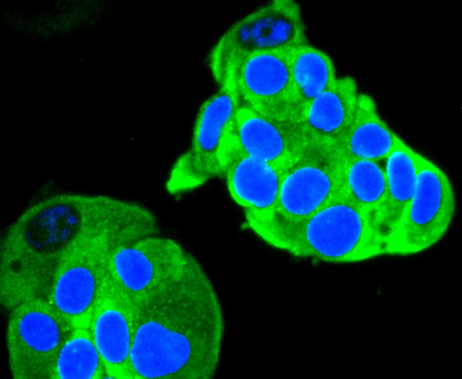 Anti-RET Antibody (8T974)