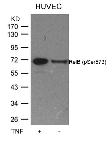 Anti-Phospho-RELB (Ser573) Polyclonal Antibody
