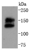 Anti-RET Antibody (8T974)