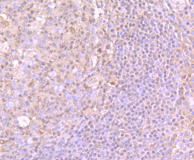 Anti-SPI1 Antibody (2J454)