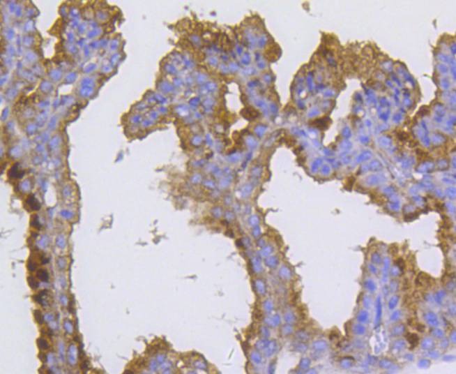 Anti-Radixin Antibody (3A6)