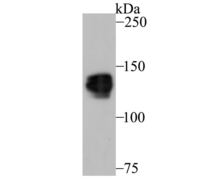 Anti-Pumilio 1 Antibody (3G125)