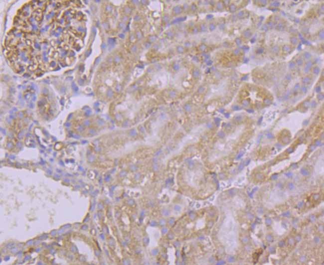 Anti-Pumilio 1 Antibody (3G125)