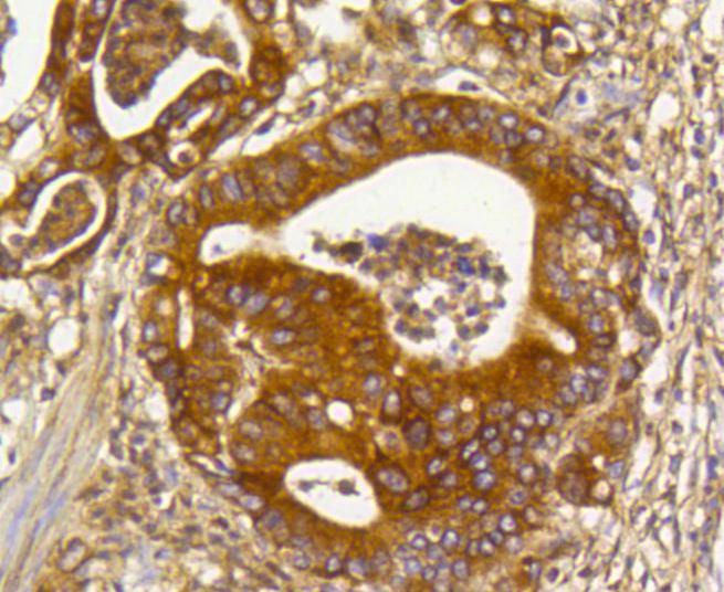 Anti-RhoA/B/C Antibody (1S695)