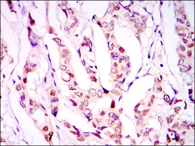 Anti-PSIP1 Antibody (7I174)
