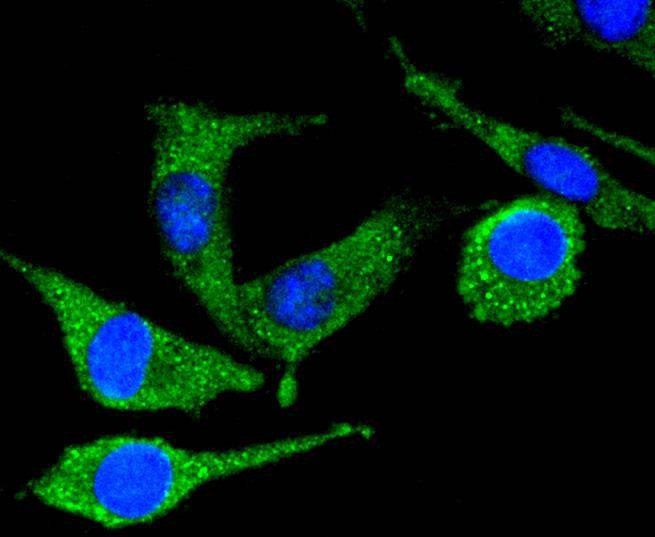 Anti-PYK2 Antibody (5I30)