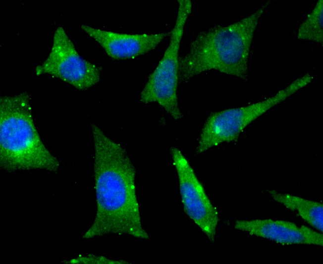 Anti-RheB Antibody (8S39)