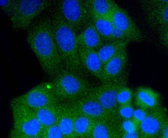 Anti-Rab9 Antibody (9V943)