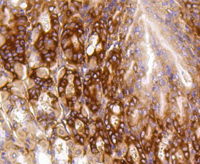 Anti-PUMA Antibody (5V529)