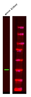 Anti-Phospho-PSEN1 (Ser353) Polyclonal Antibody