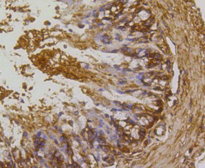 Anti-RhoA/B/C Antibody (1S695)