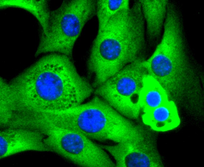 Anti-RAD18 Antibody (5U394)