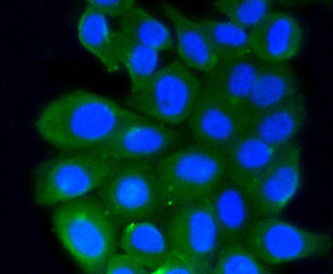 Anti-RhoA/B/C Antibody (1S695)