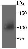 Anti-PYK2 Antibody (5I30)