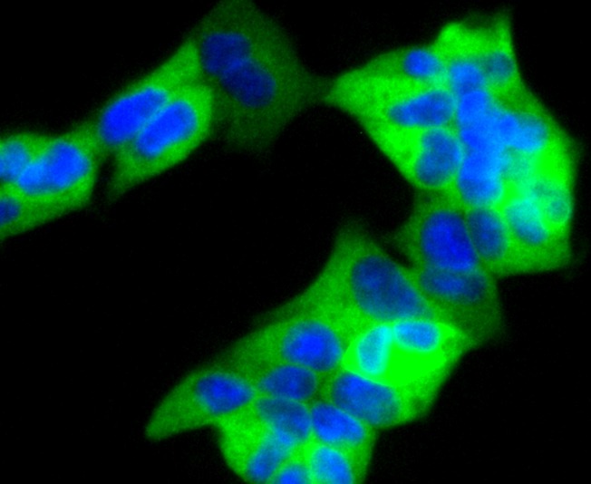 Anti-RAD18 Antibody (5U394)
