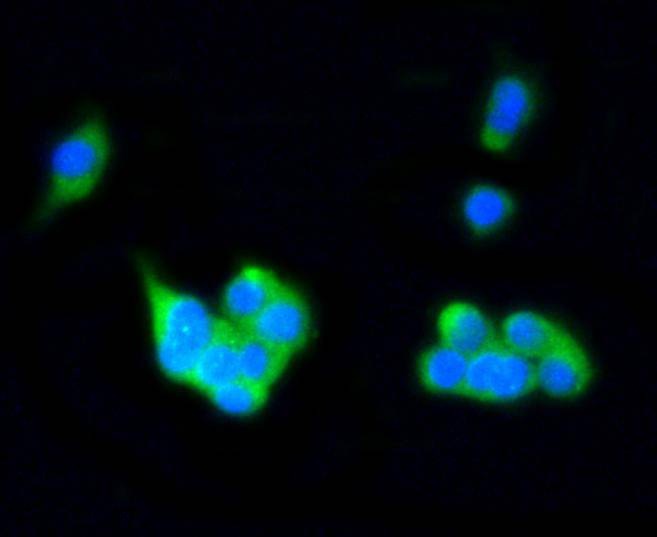Anti-Rab4A Antibody (4X108)