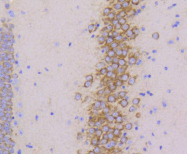 Anti-PYK2 Antibody (5I30)