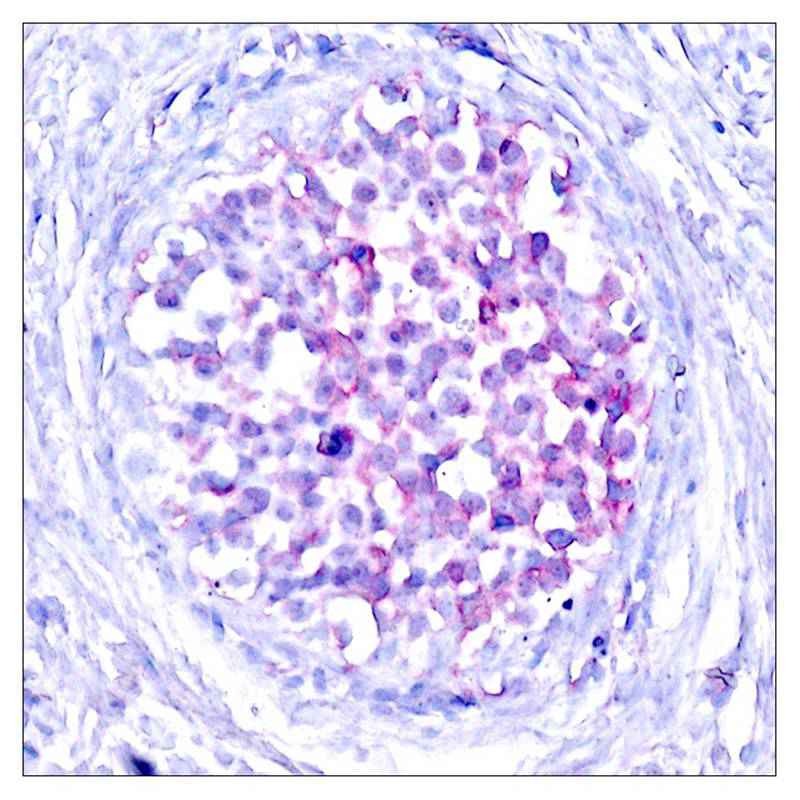 Anti-Phospho-RAF1 (Ser259) Polyclonal Antibody