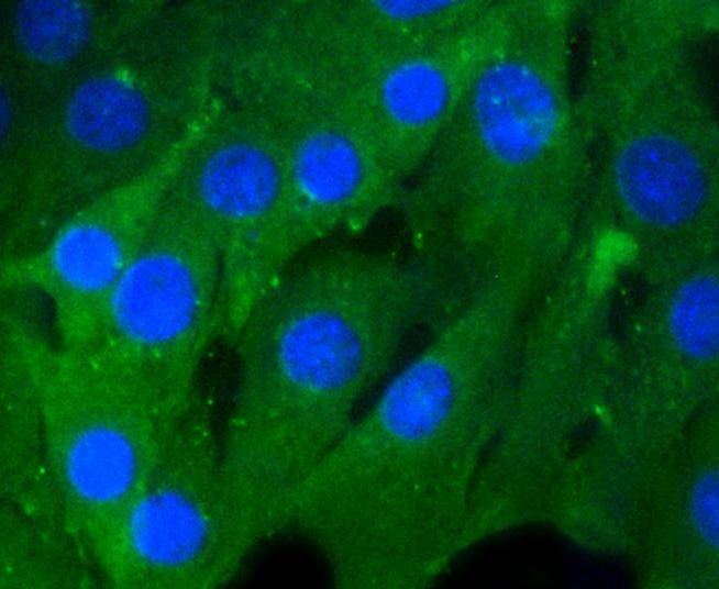 Anti-RhoA/B/C Antibody (1S695)