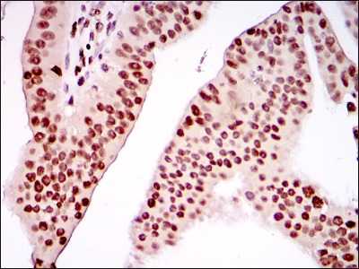 Anti-PSIP1 Antibody (7I174)