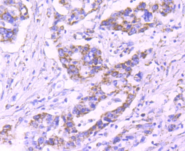 Anti-PDHB Antibody (9C498)