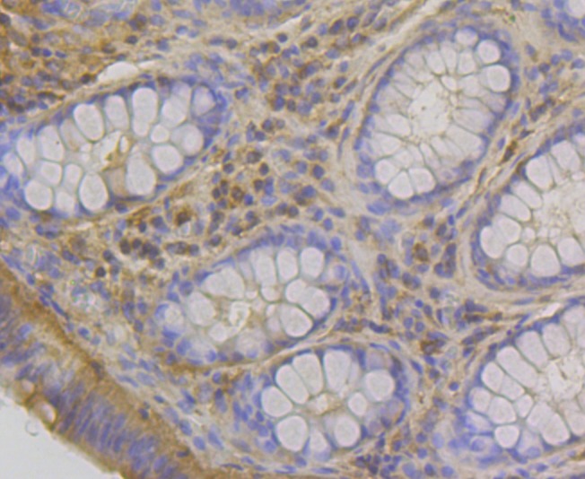 Anti-RheB Antibody (8S39)