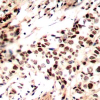 Anti-Phospho-RAD51 (Tyr315) Polyclonal Antibody