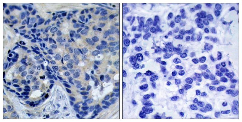 Anti-Phospho-PYK2 (Tyr402) Polyclonal Antibody