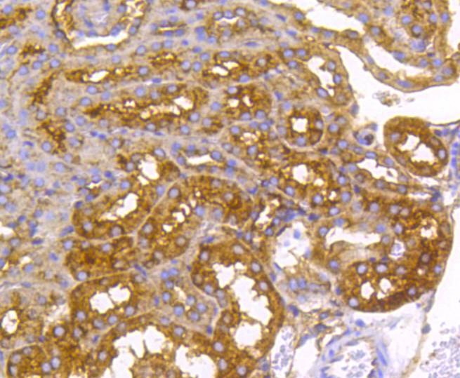 Anti-Radixin Antibody (3A6)