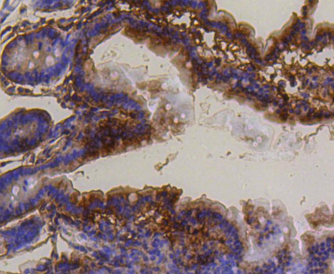 Anti-PUMA Antibody (5V529)