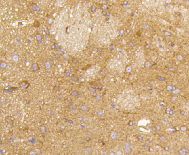 Anti-RAB5A Antibody (6H506)