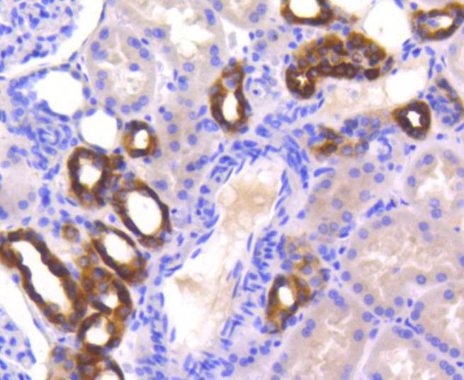Anti-PYK2 Antibody (5I30)