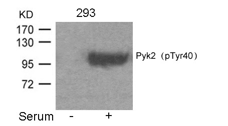Anti-Phospho-PYK2 (Tyr402) Polyclonal Antibody