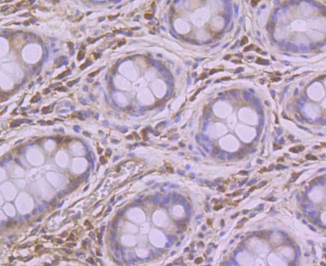Anti-Pumilio 1 Antibody (3G125)