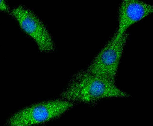 Anti-PYK2 Antibody (5I30)