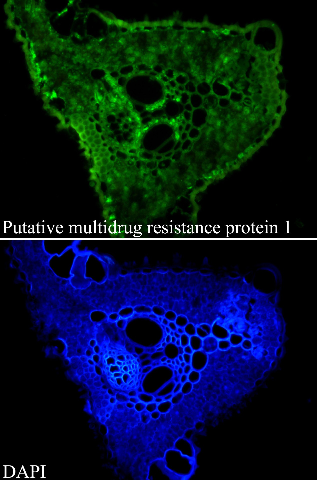 Anti-Putative multidrug resistance protein 1 Antibody (2F127)