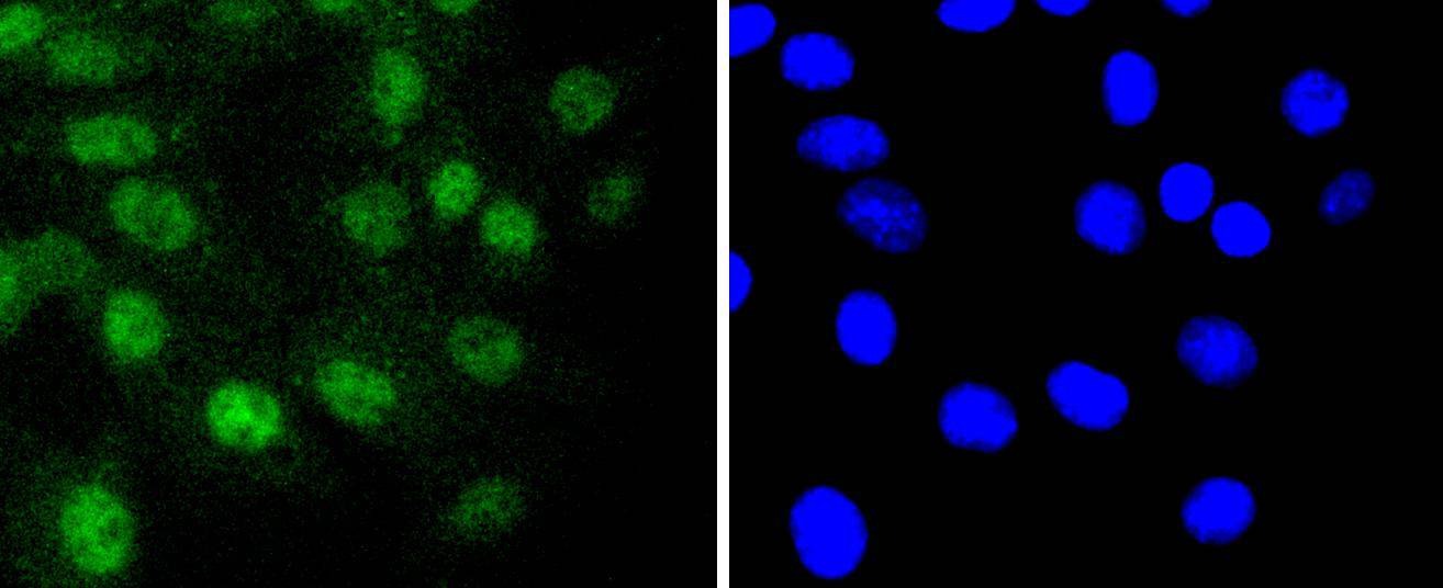 Anti-RUNX1/RUNX2/RUNX3/RUNX2/RUNX3 Antibody (4N296)