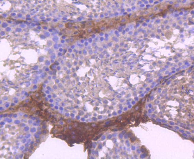 Anti-RUNX1/RUNX2/RUNX3/RUNX2/RUNX3 Antibody (4N296)