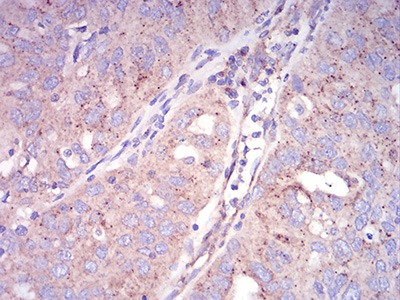 Anti-SEC31A Antibody (5Y312)