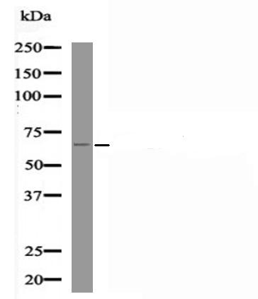 Anti-Phospho-RUNX2 (Ser451) Polyclonal Antibody