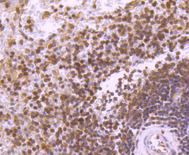 Anti-STAT5B Antibody (1Y166)