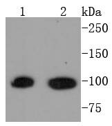 Anti-STAT6 Antibody (8C359)