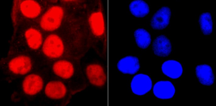 Anti-SMC3 Antibody (2D413)