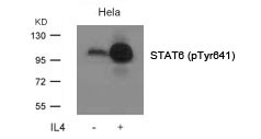 Anti-Phospho-STAT6 (Tyr641) Polyclonal Antibody 2