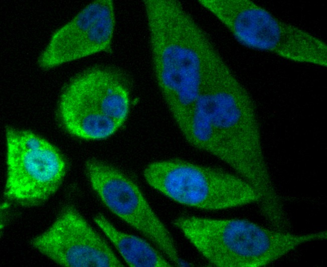 Anti-SOCS2 Antibody (9S693)