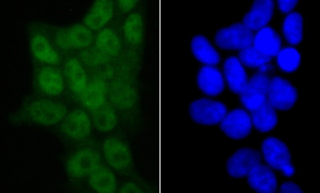 Anti-SMARCC1 Antibody (6J524)