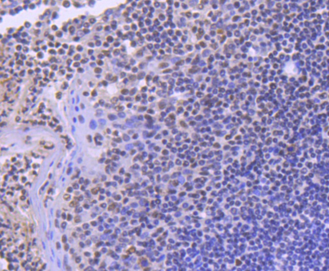 Anti-SMC1A Antibody (7H408)