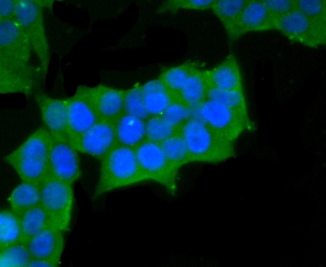 Anti-smooth muscle Myosin heavy chain 11 Antibody (7J784)